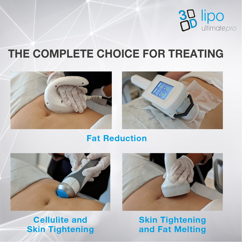 The Complete Choice for Treating